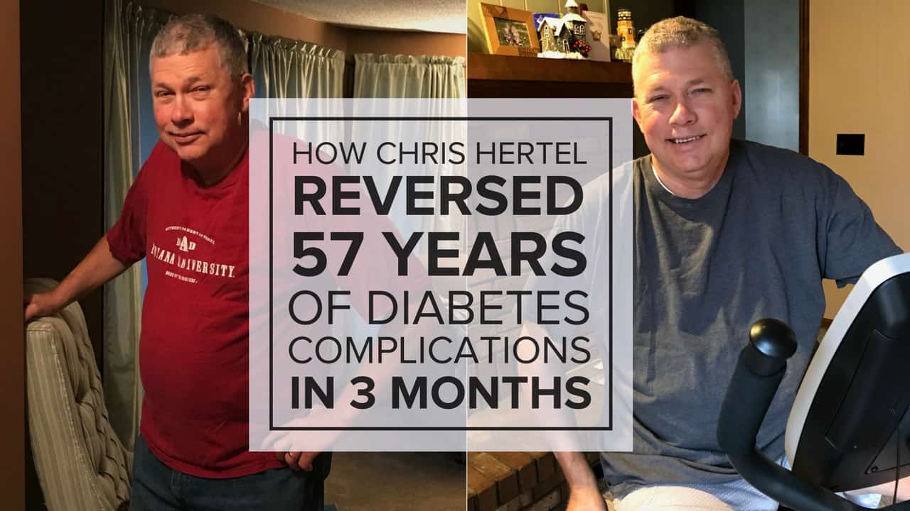 Diabetes-Complications Diabetes-Complications