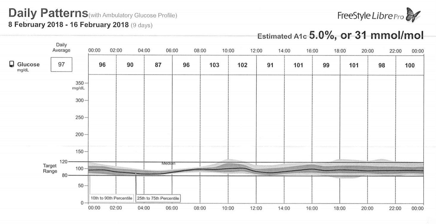 blood glucose over time