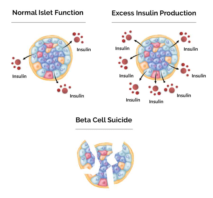 How Fat Kills Insulin Producing Beta Cells