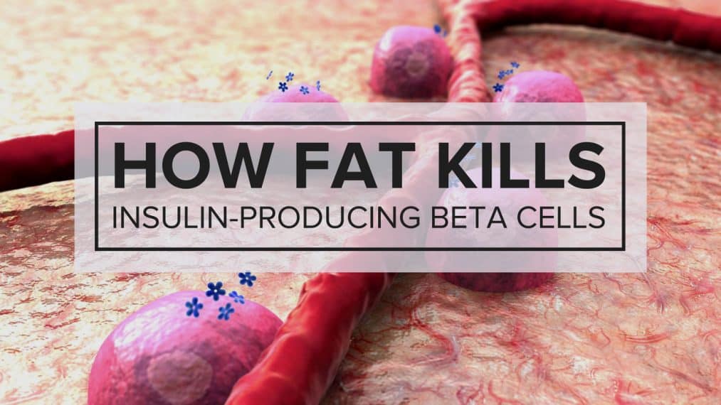 How-Fat-Kills-Beta-Cells