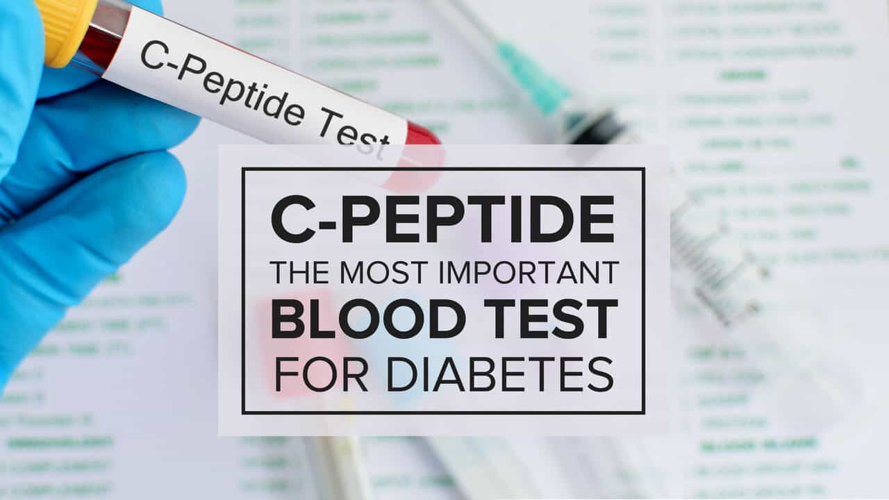 C-Peptide-Diabetes-Blood-Test
