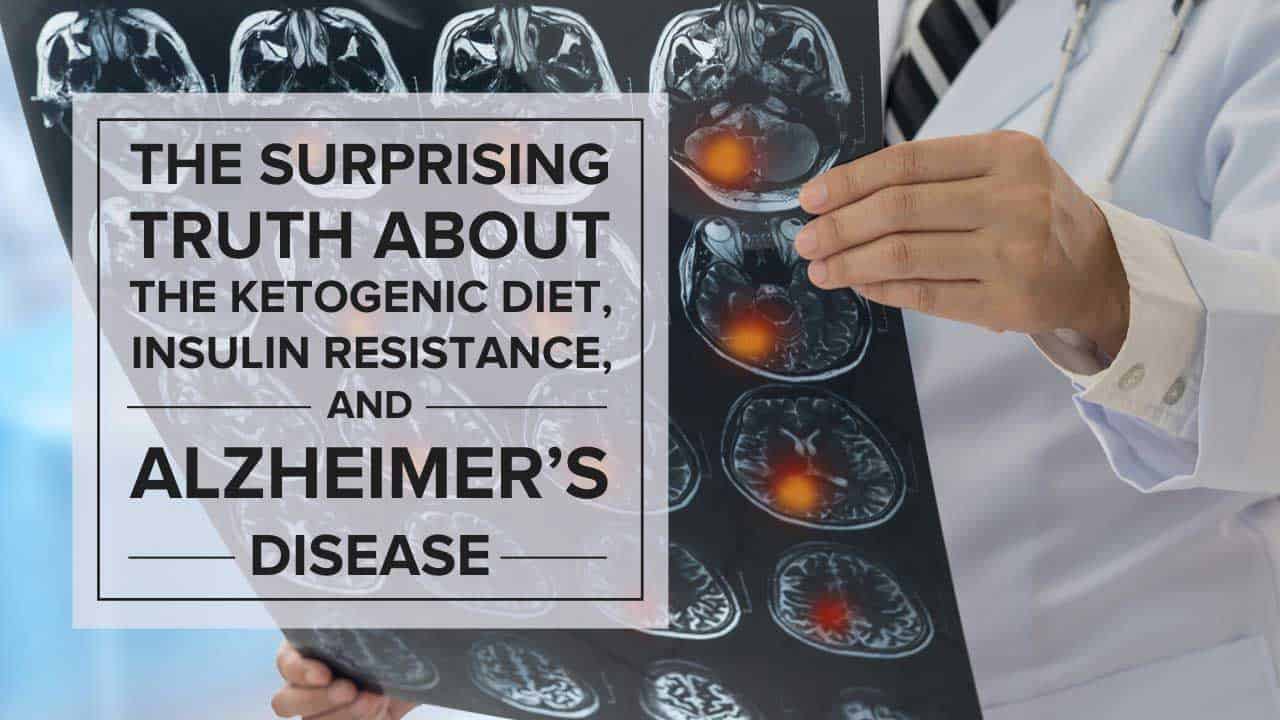 Doctor holding MRI images of a human brain