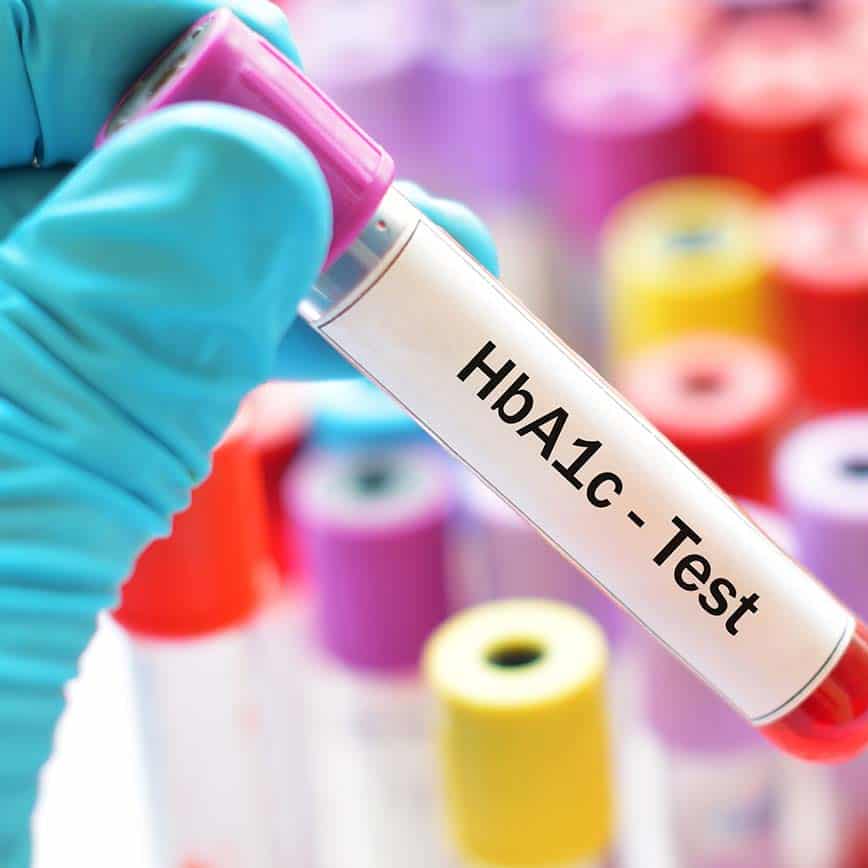 A1c-test-square