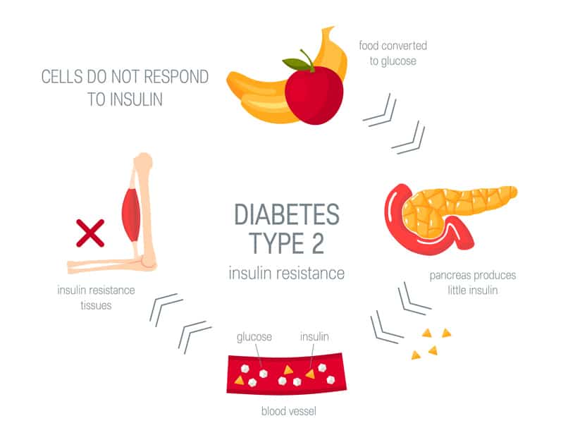 Type-2-Diabetes