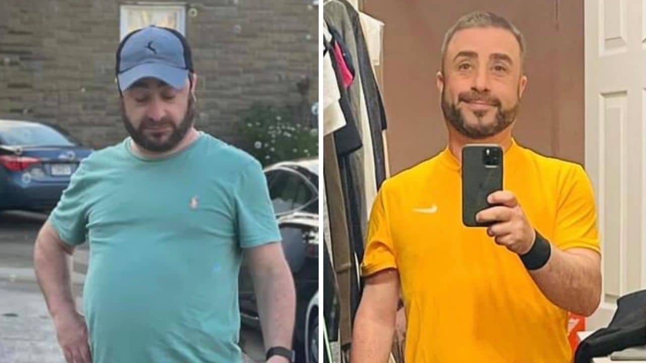 Richard - Before & After