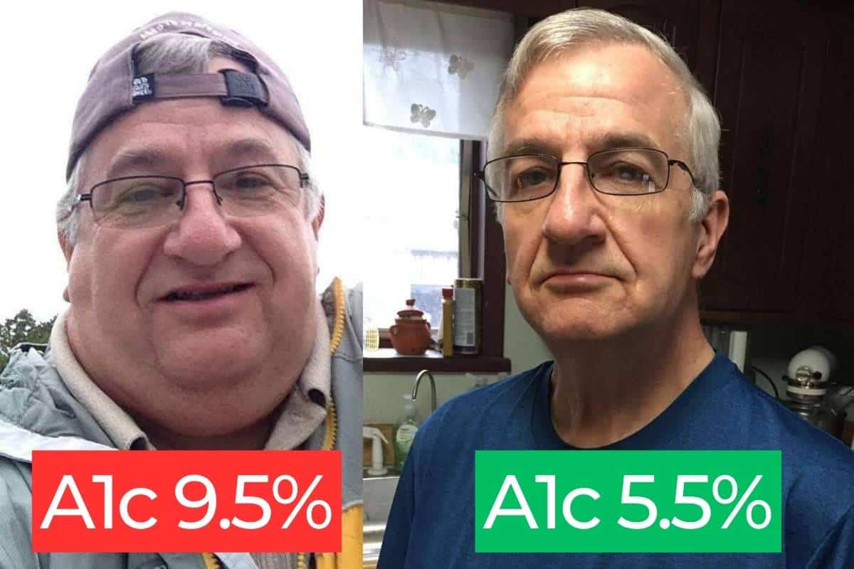 David Before and After