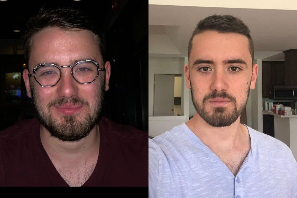 Stephen Guidonne Before and After