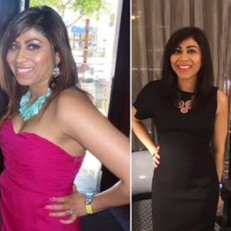 Kinjal Before and After