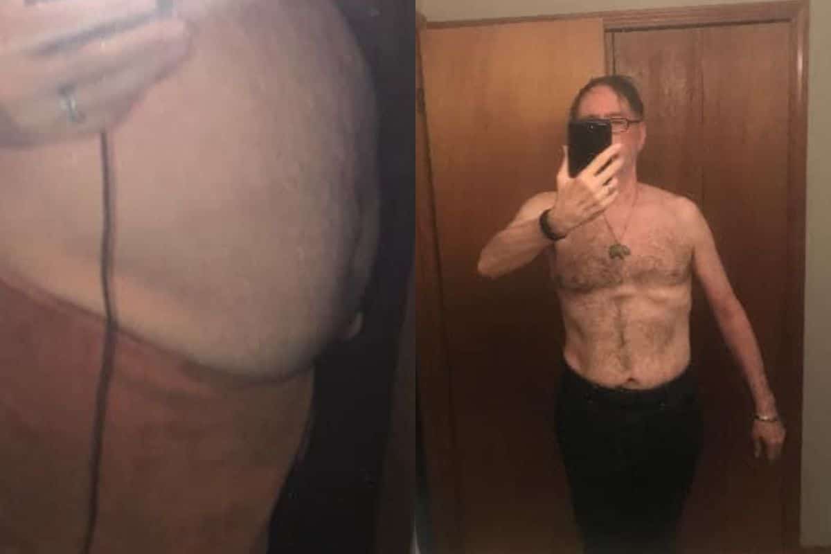 Tony Before and After