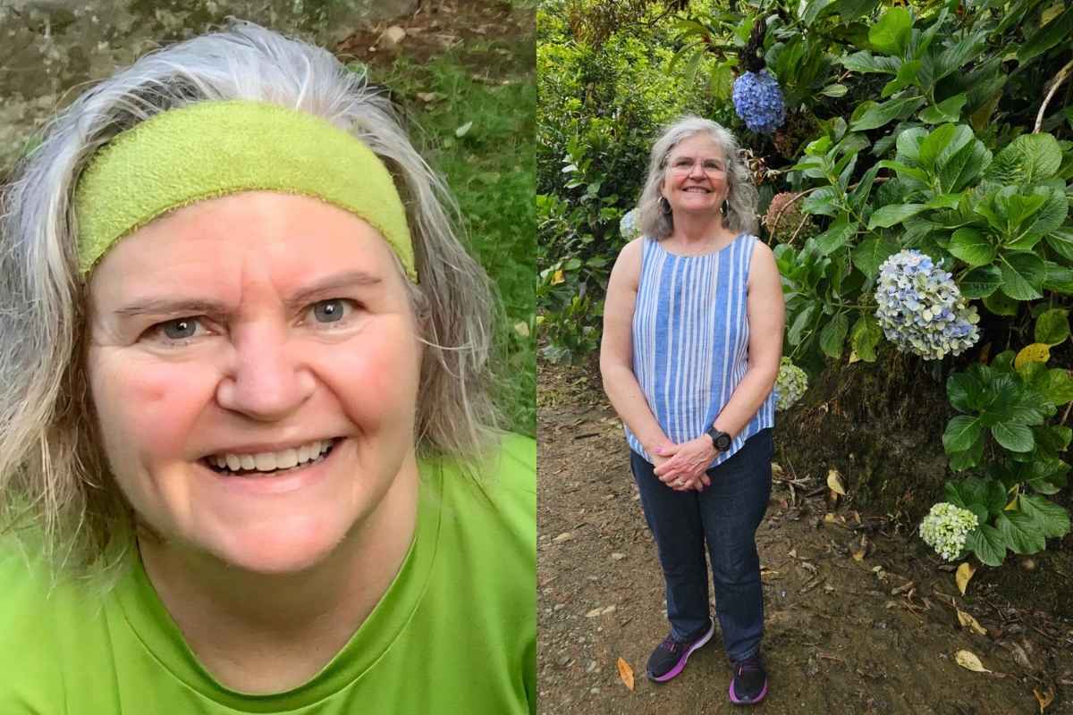 Anne Before and After