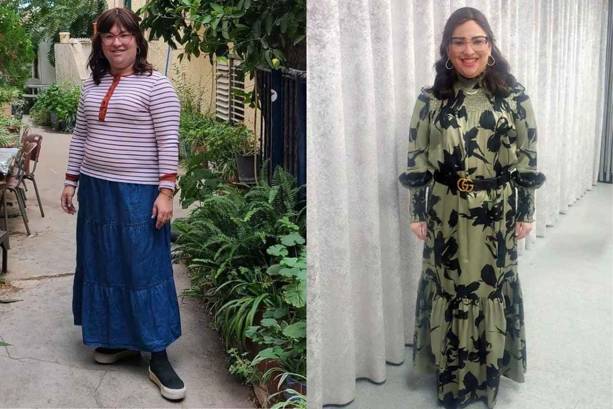 Faigy Before and After