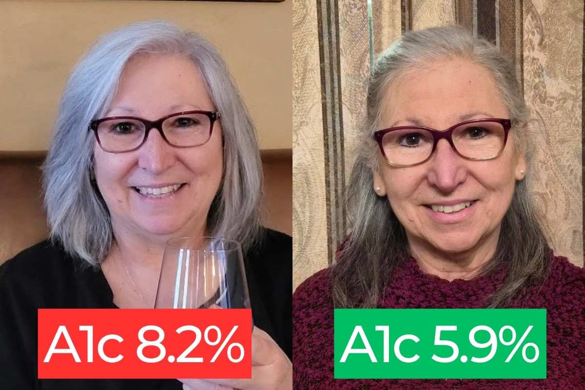Barbara Before and After