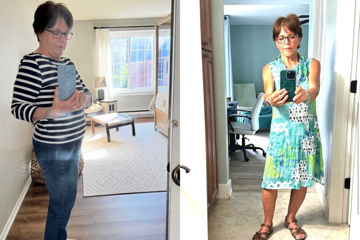 Susan Before and After