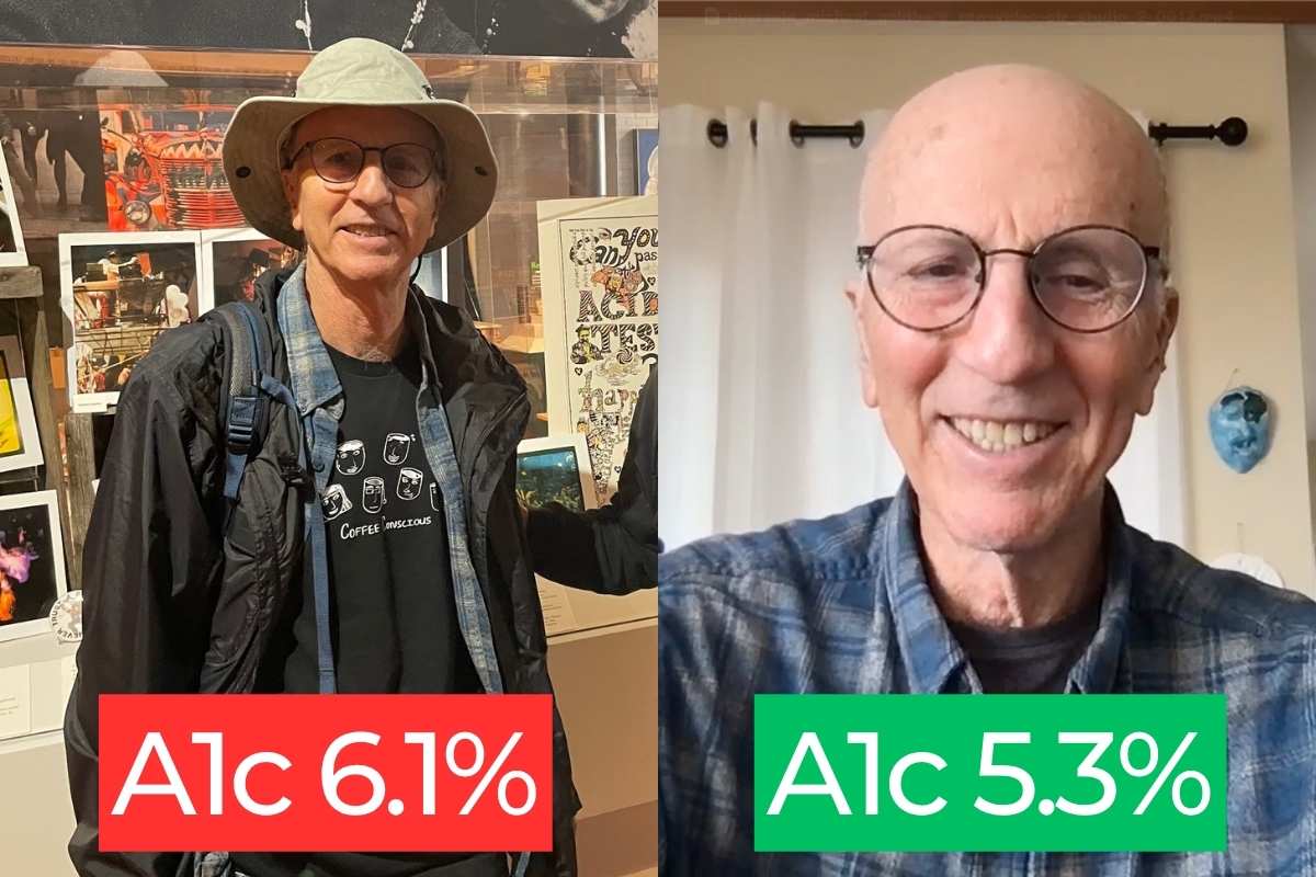 Michael Before and After A1c