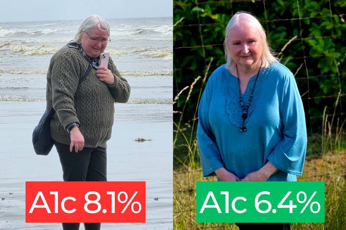 Cindy Before and After A1c